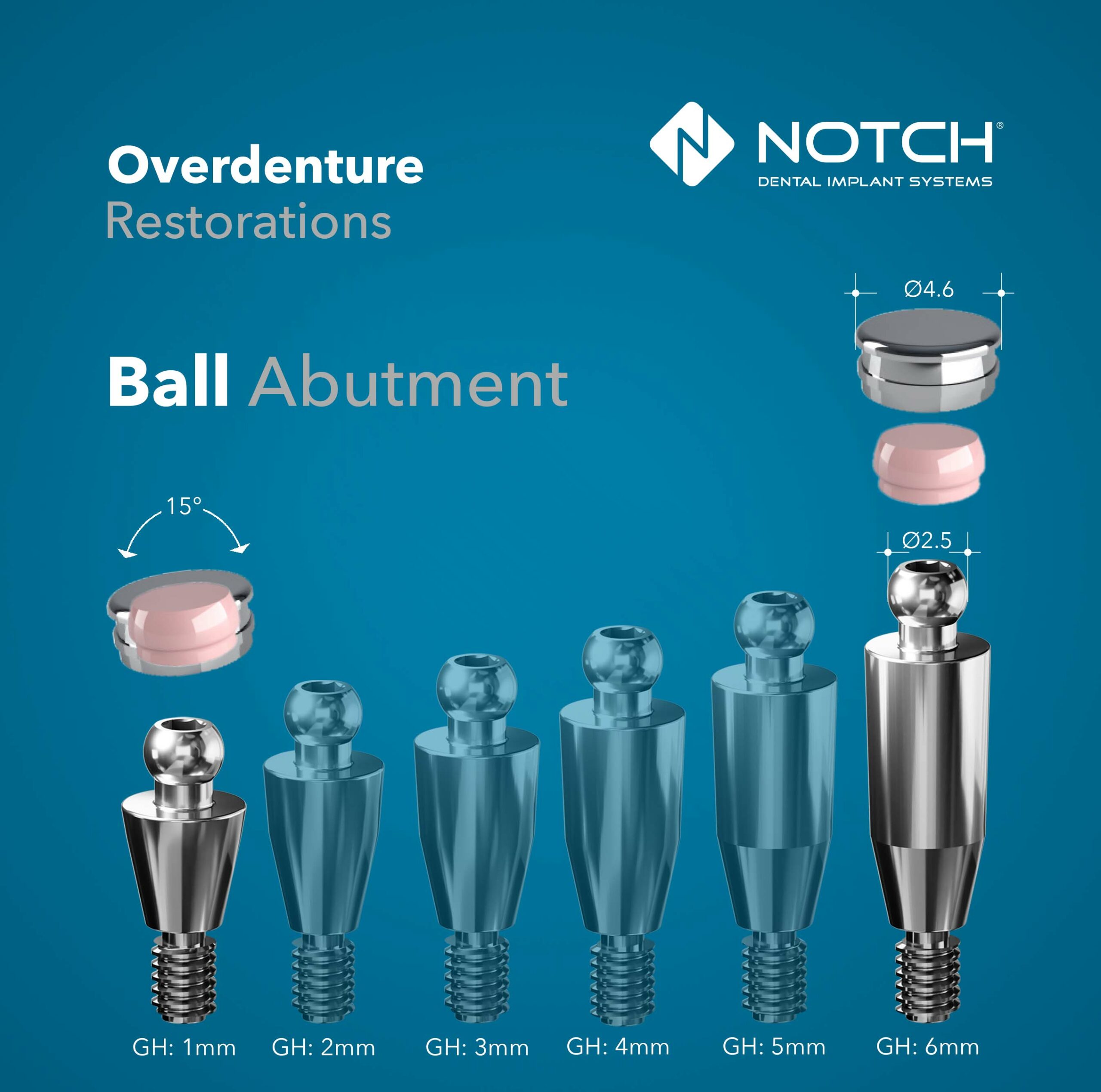Ball Abutments Overdenture Restoration, Ball Abutment Illustration